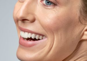 Chester Cosmetic Lines and Wrinkles