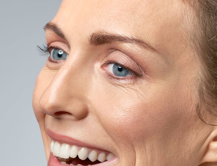 Chester Cosmetic Lines and Wrinkles