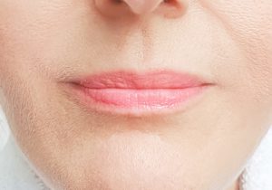 Chester Cosmetic Surgery THIN LIPS