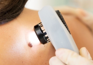 Skin Cancer Treatments
