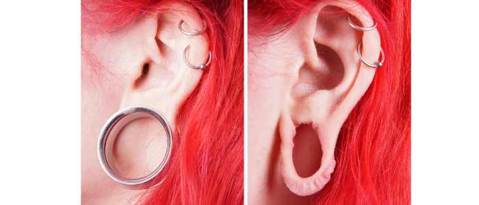 How to prevent torn earlobes