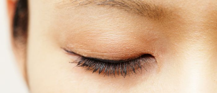 Treatment to reduce eyelid surgery scars