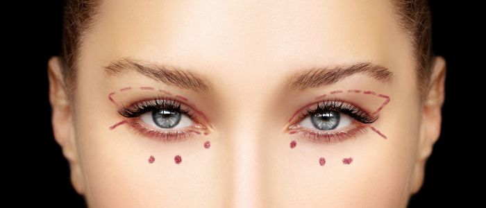 During Eyelid Surgery FAQs