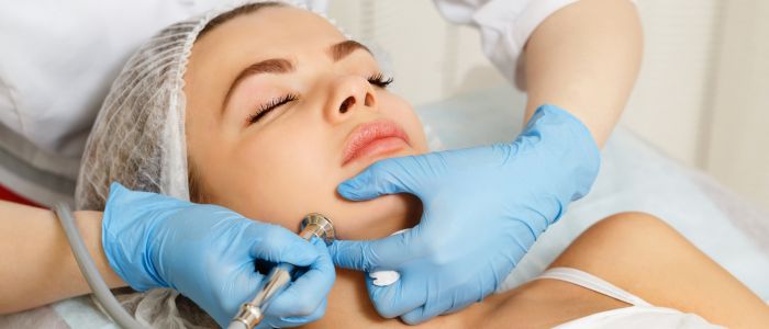 Microdermoabrasion for Scars Treatment