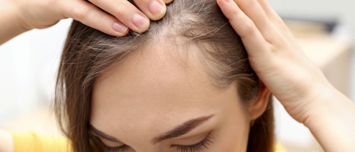 Types of scarring hair loss